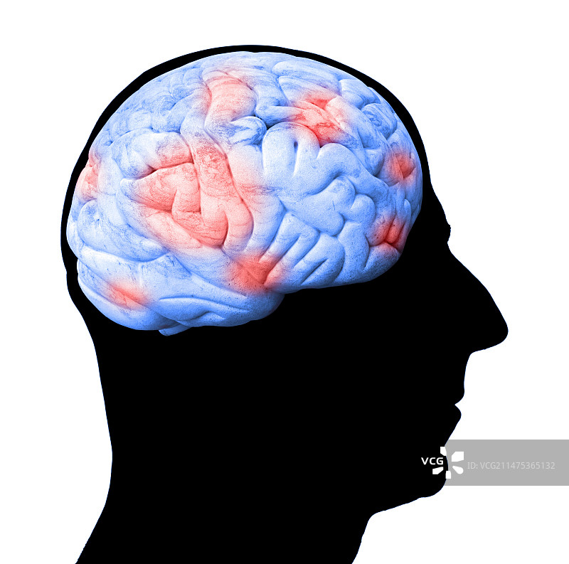 大脑活动概念图图片素材