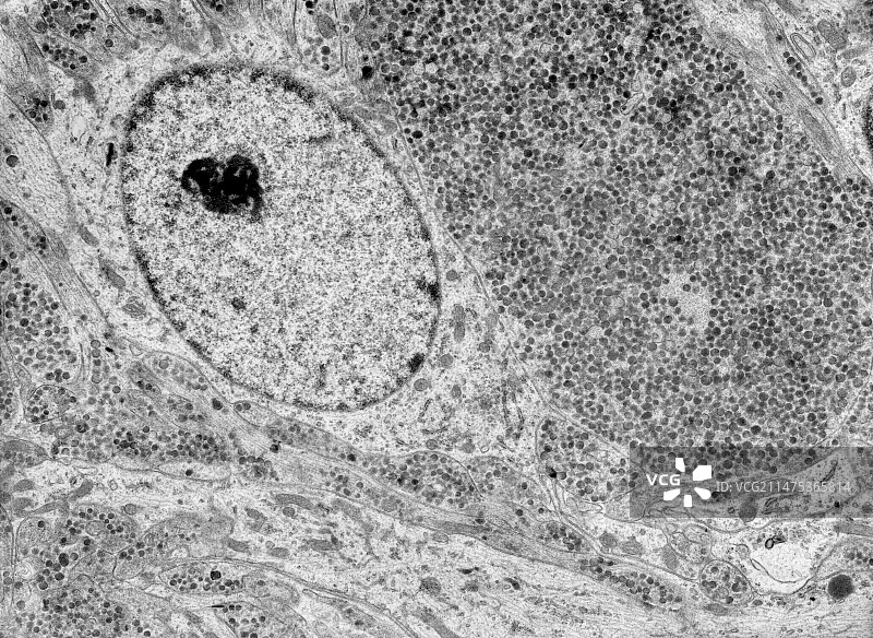 垂体后叶，赫林体，TEM图片素材