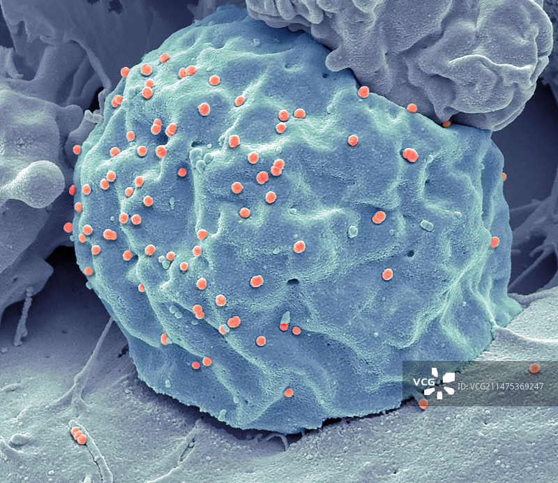 艾滋病毒病毒载体，扫描电镜图片素材