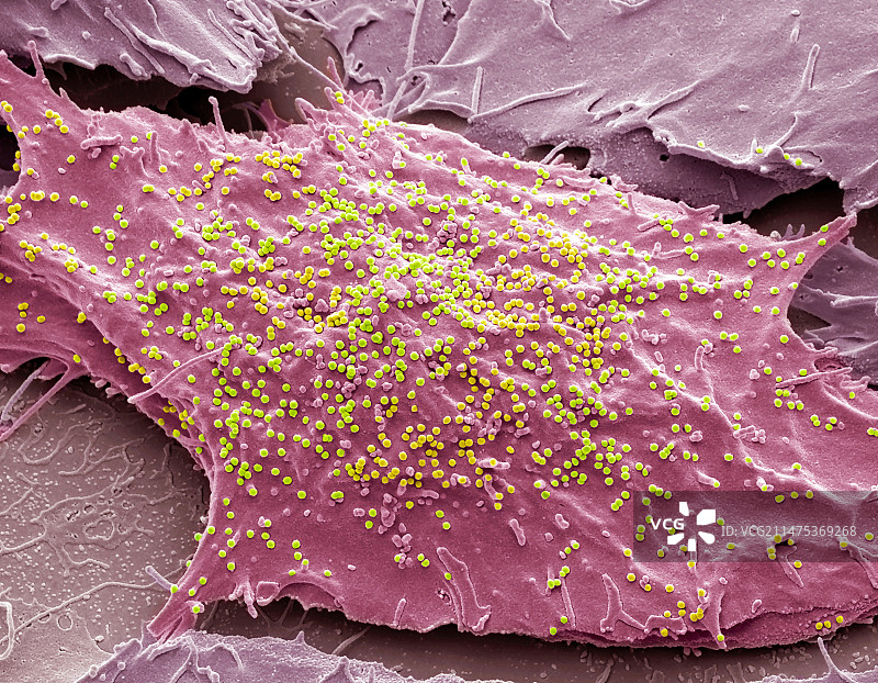 SIV感染细胞,SEM图片素材