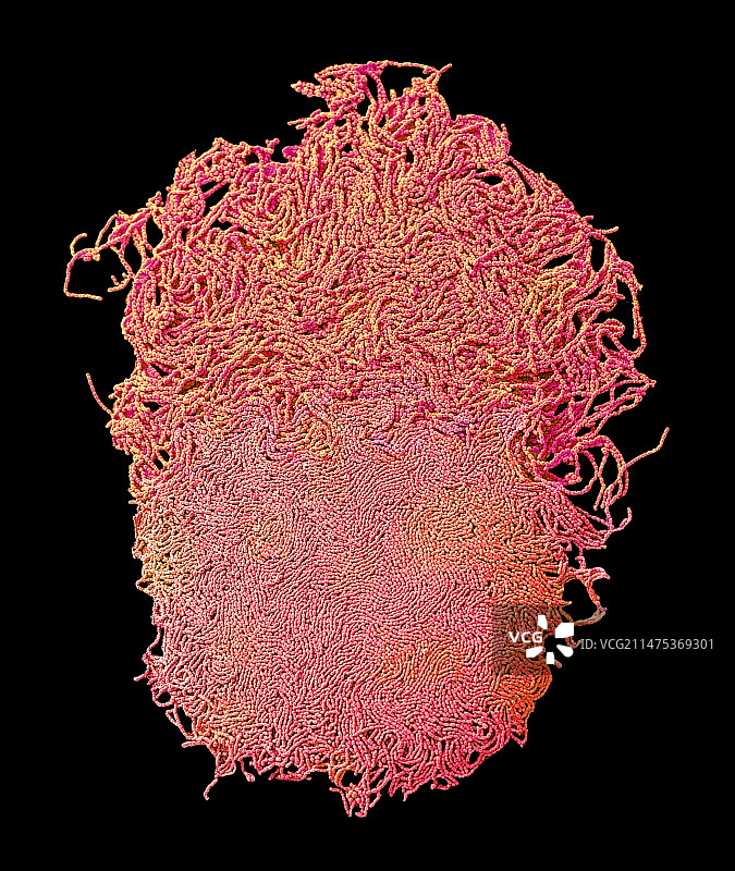 痰培养，扫描电子显微镜图片素材