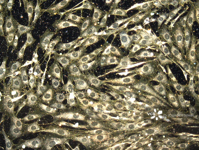 癌细胞中的金色纳米颗粒，光学显微照片图片素材
