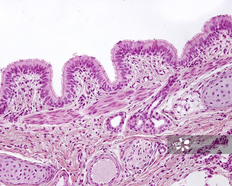 支气管壁显微照片图片素材