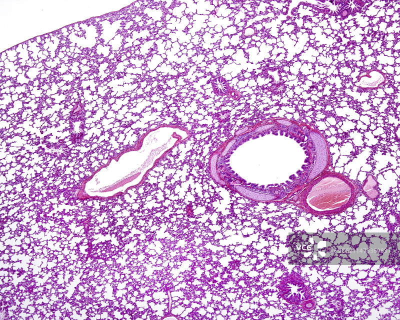肺萎陷，光学显微照片图片素材