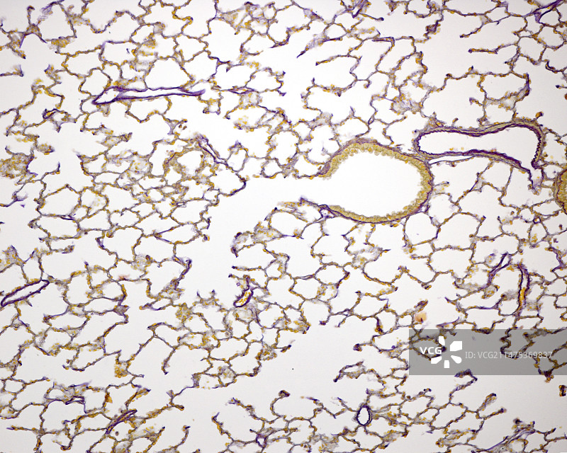 肺内气道显微照片图片素材