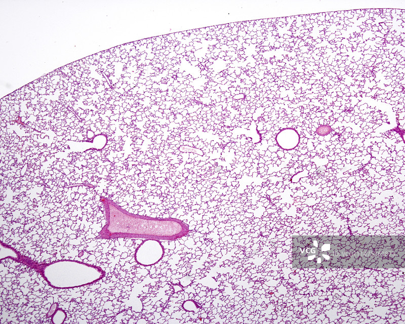 肺实质，光学显微照片图片素材