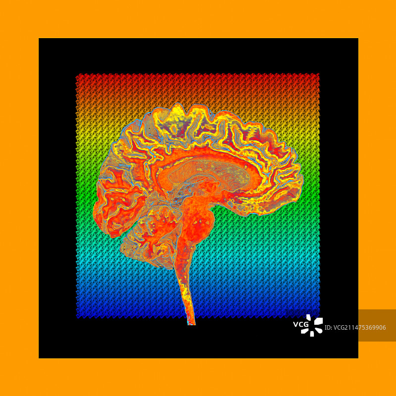 人脑矢状位核磁共振扫描抽象图图片素材