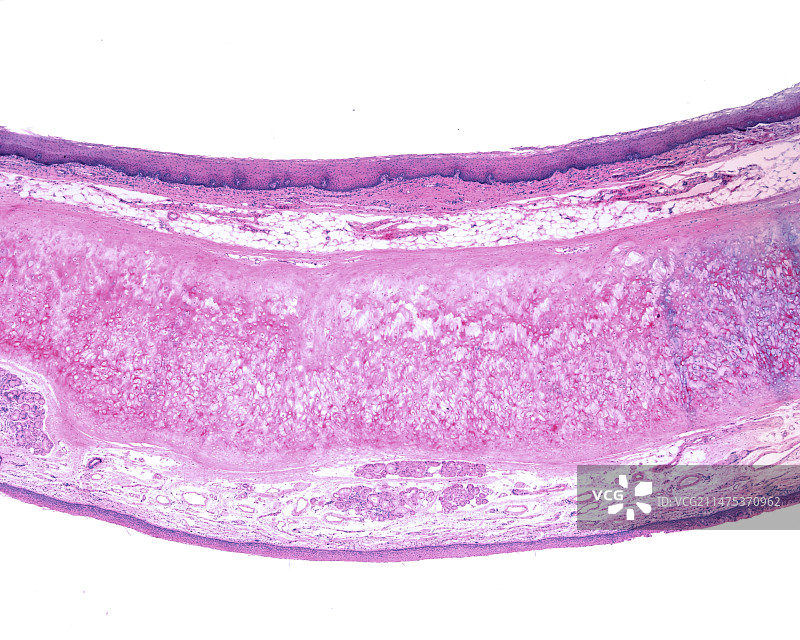 人体的epiglottis亮视野显微照片图片素材