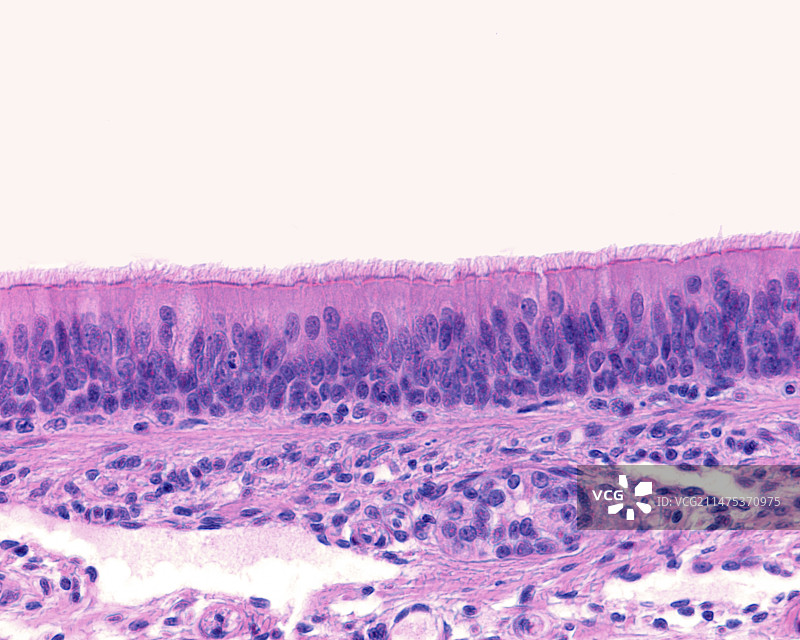 气管黏膜显微照片图片素材