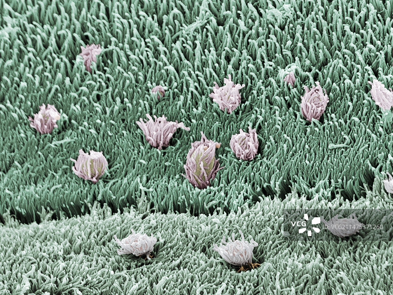 绦虫表面扫描电镜图图片素材