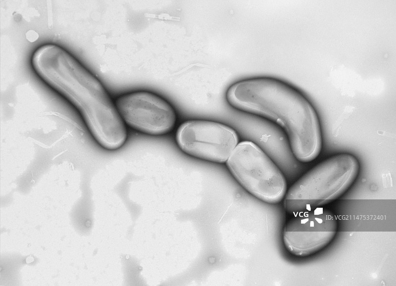 奇异分枝杆菌，透射电镜图片素材