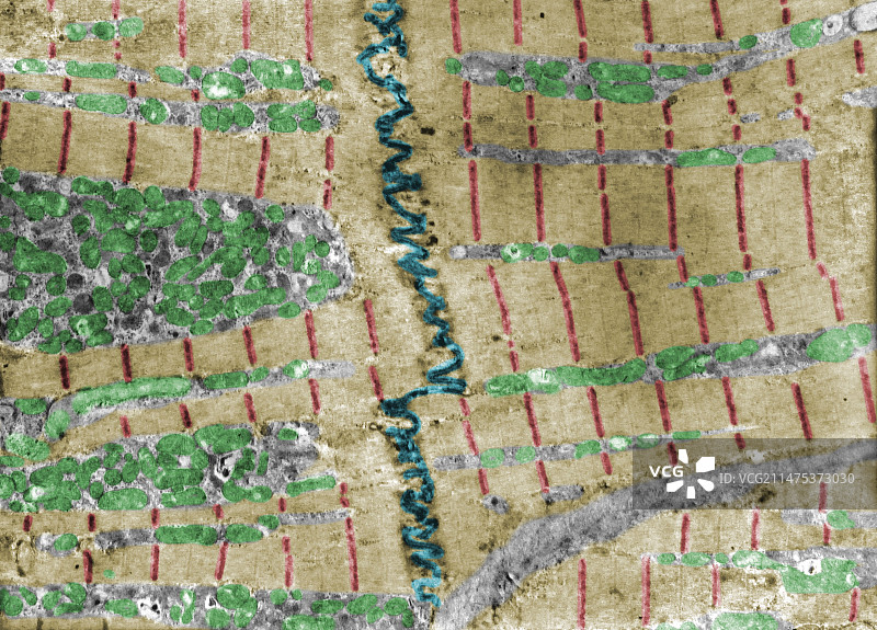 心肌透射电镜图图片素材