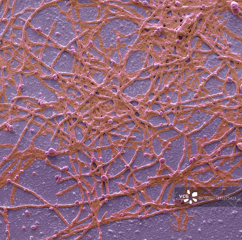 放线菌病扫描电镜图图片素材