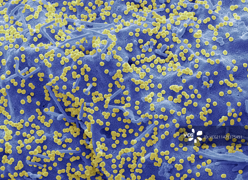 感染HIV的293T细胞扫描电镜图图片素材