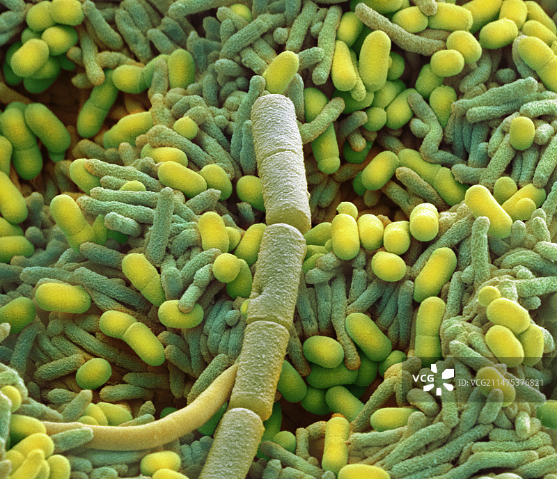 家用洗碗机中的细菌（扫描电子显微镜）图片素材