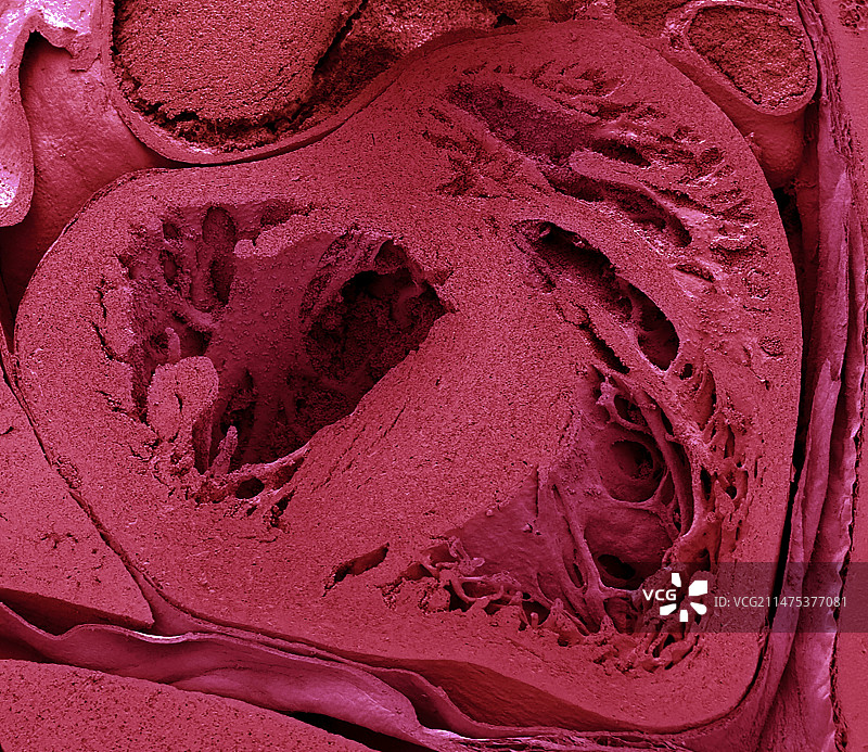 小鼠胚胎心脏扫描电镜图图片素材