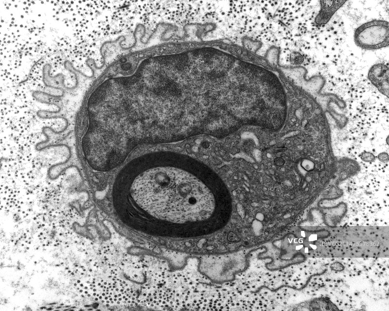 再生神经细胞，透射电镜图片素材