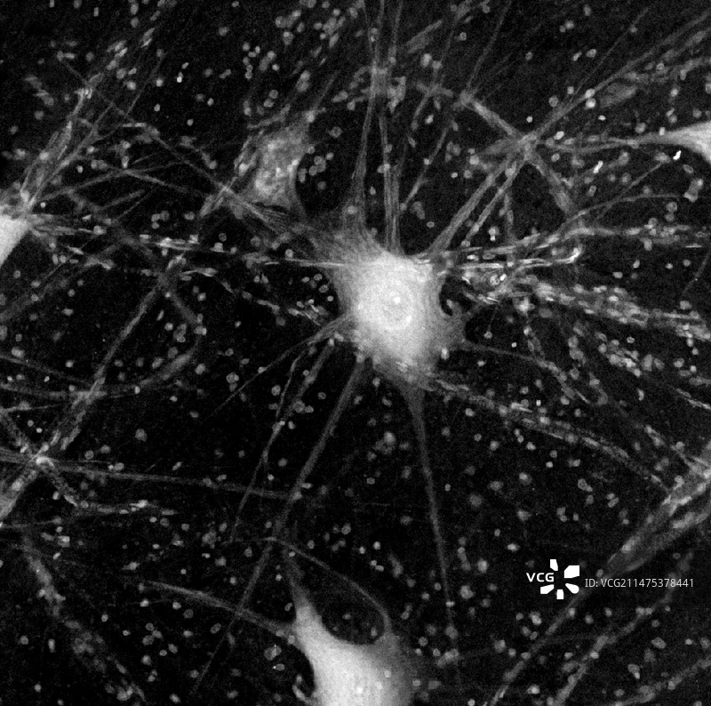 运动神经元显微照片图片素材