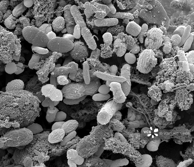 粪便细菌扫描电镜图图片素材