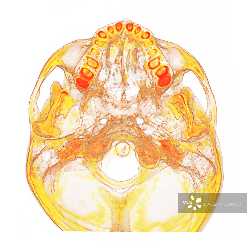 颅底3D CT扫描图片素材