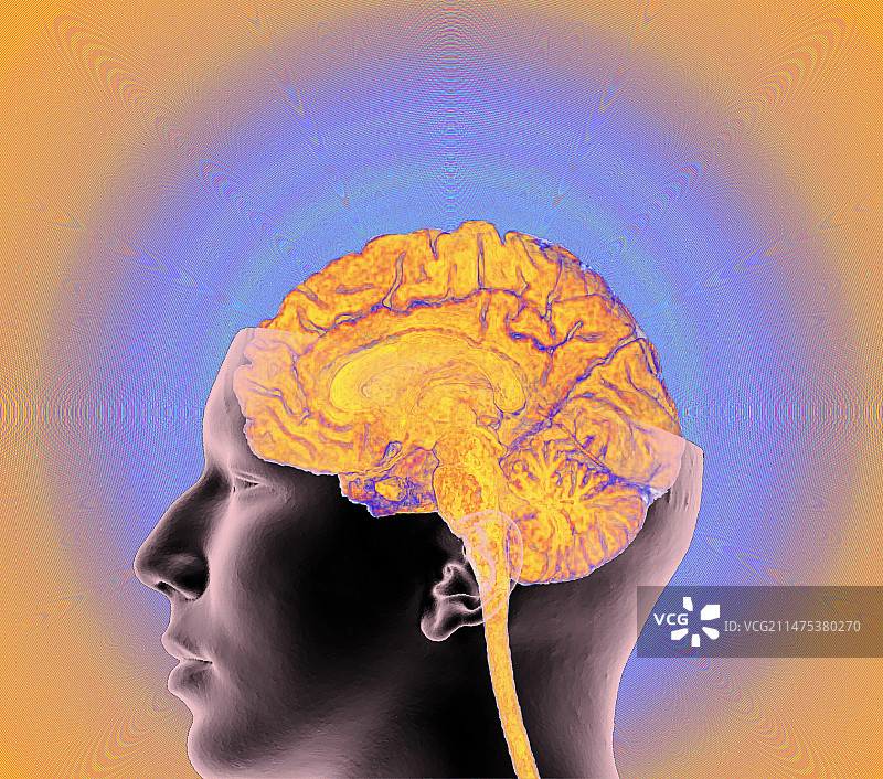 人脑部CT和MRI扫描图片素材