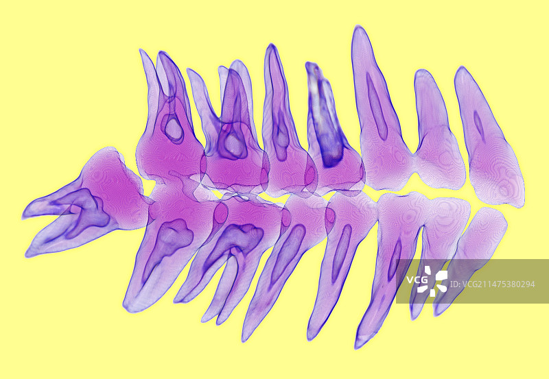 人类牙齿3D CT扫描图片素材