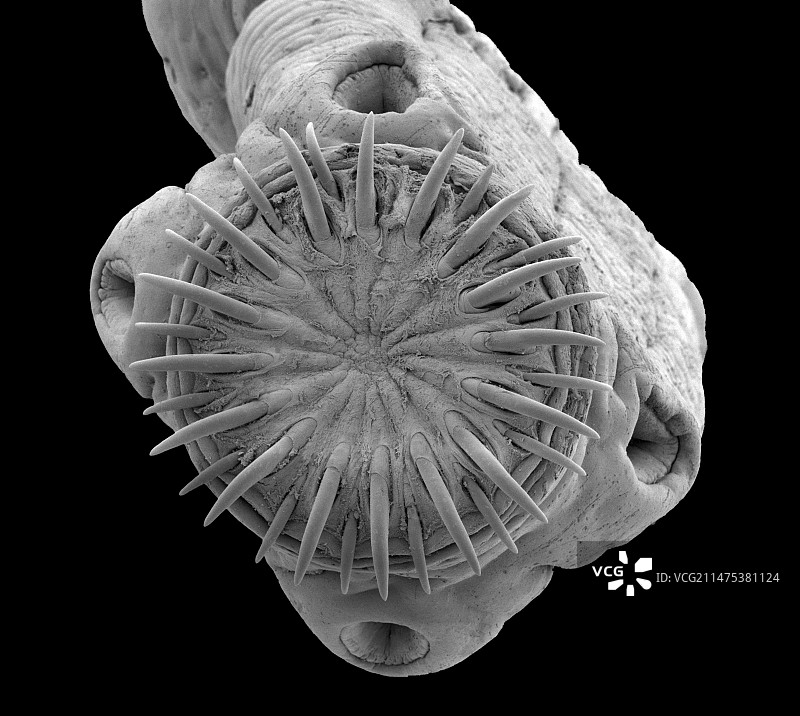 猪肉绦虫扫描电镜图图片素材