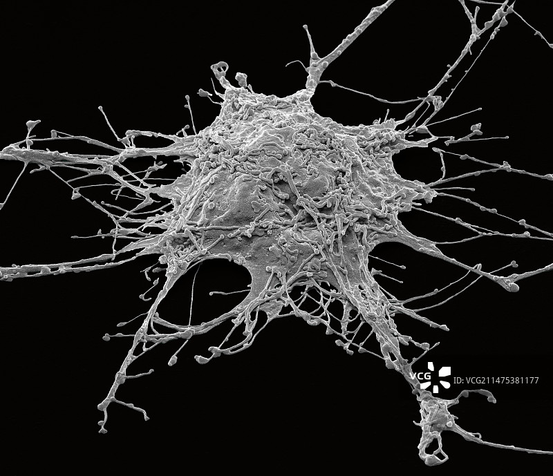 神经元扫描电镜图图片素材