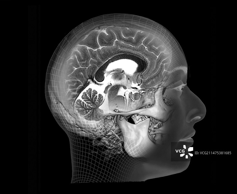 人脑MRI扫描图片素材