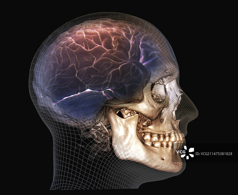 人体 skull 和大脑3D CT扫描图片素材