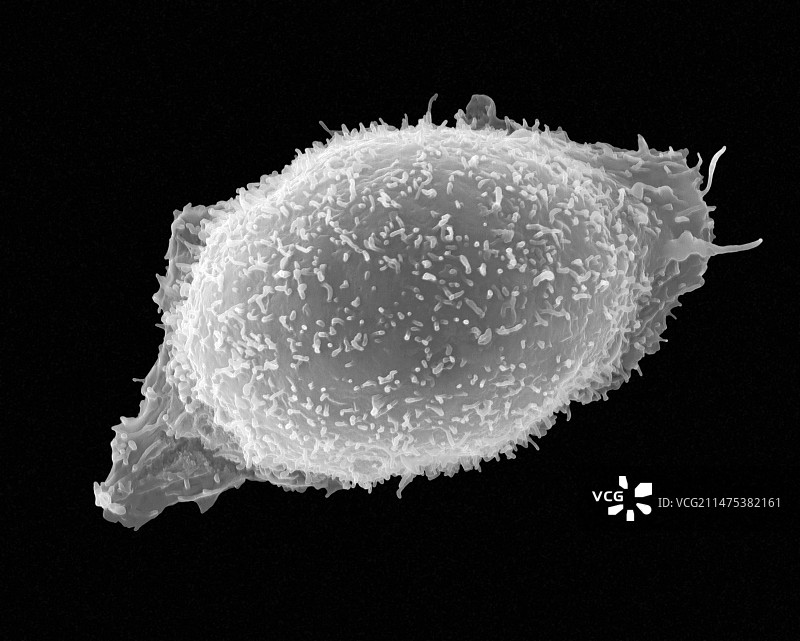 肥大细胞扫描电镜图图片素材