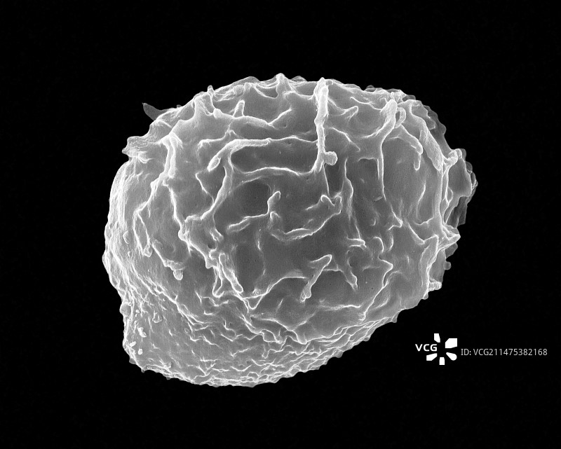 粒状白细胞扫描电镜图图片素材