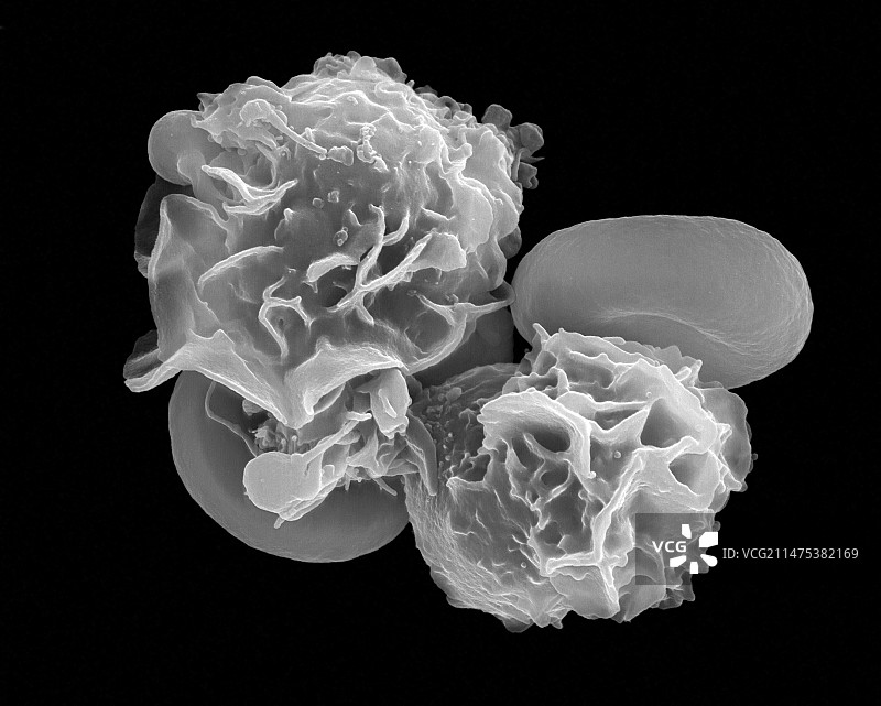 中性粒细胞和红细胞扫描电镜图图片素材