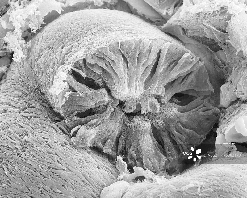 肾小管扫描电镜图图片素材