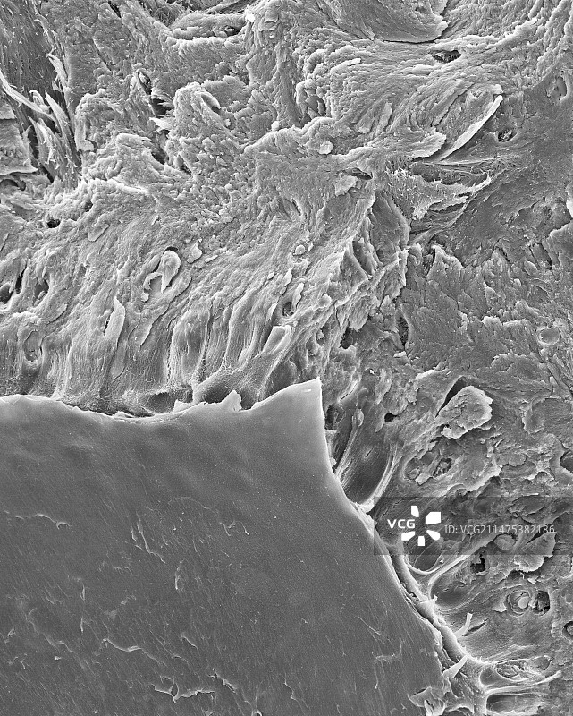 骨折的致密骨中的骨细胞，扫描电镜图片素材