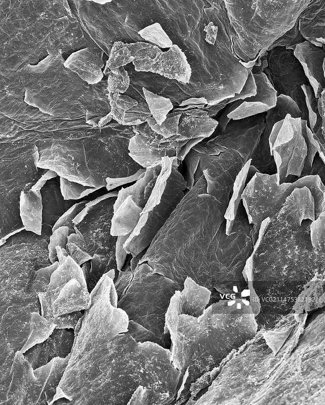 人体皮肤表皮，扫描电镜图片素材