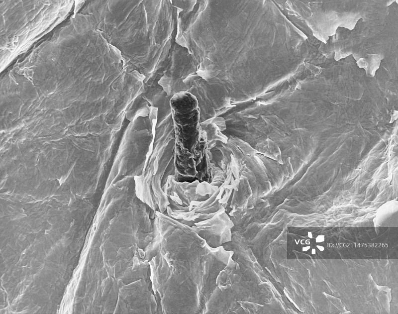 人体皮肤和毛囊SEM图像图片素材