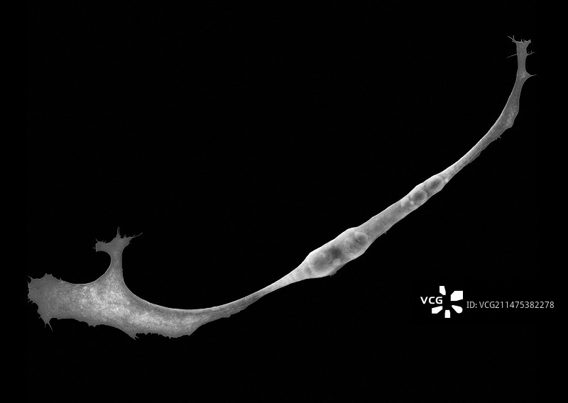 培养皿中的骨骼肌细胞扫描电镜图图片素材