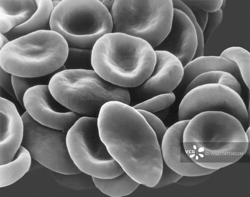 镰状细胞人血电镜扫描图图片素材