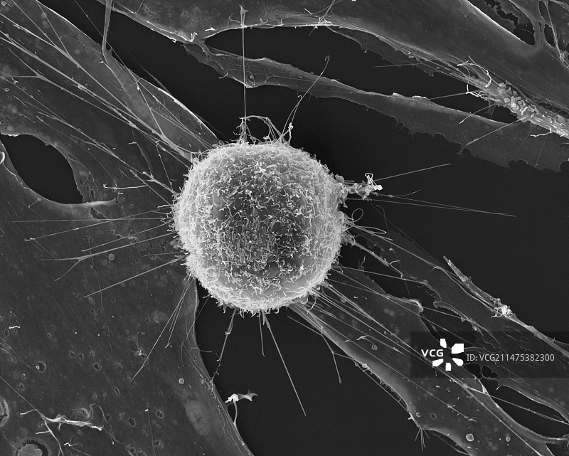 T淋巴细胞攻击肿瘤细胞扫描电镜图图片素材