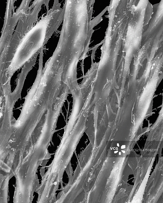 骨骼肌肌管扫描电镜图图片素材