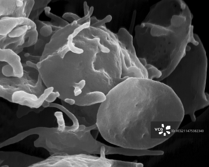 激活和未激活的血小板扫描电镜图图片素材