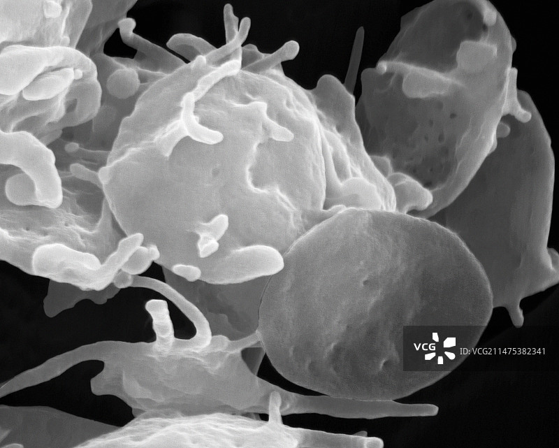 激活和未激活的血小板扫描电镜图图片素材