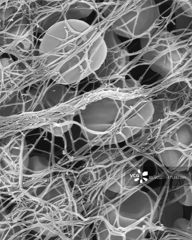 血凝块中的红细胞，SEM图片素材