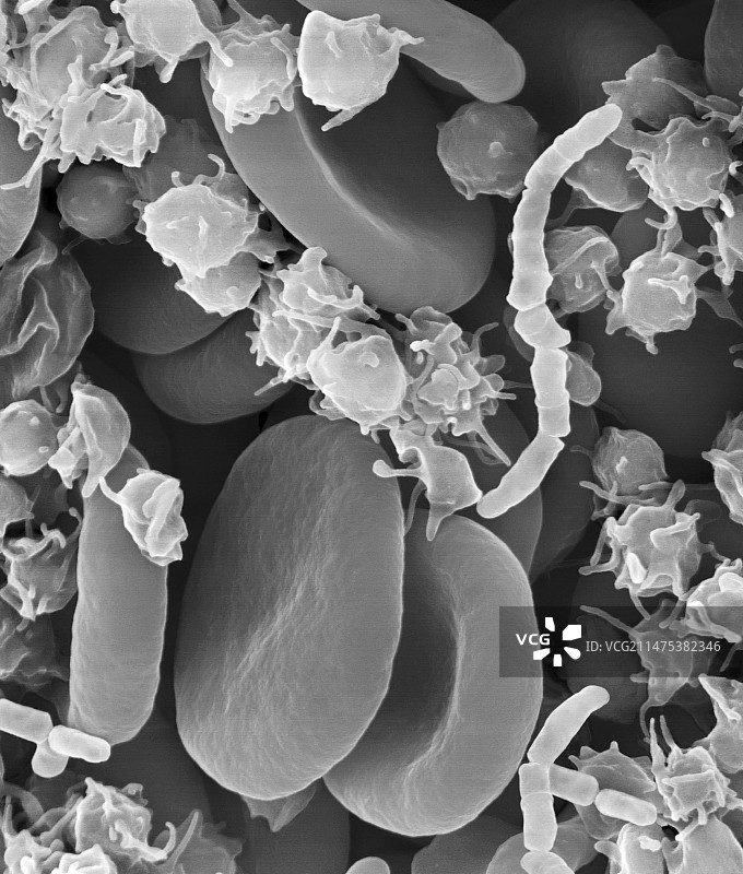 细菌性血液感染（败血症），扫描电子显微镜图片素材