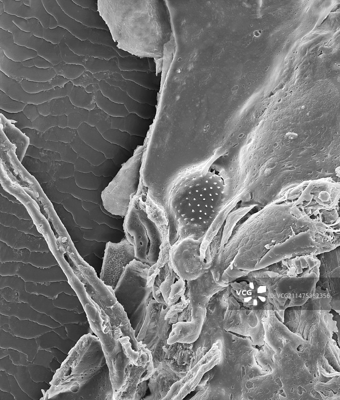 带有粘液和花粉颗粒的鼻毛，扫描电镜图片素材