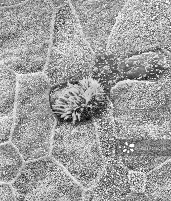 鼻咽上皮表面扫描电镜图图片素材