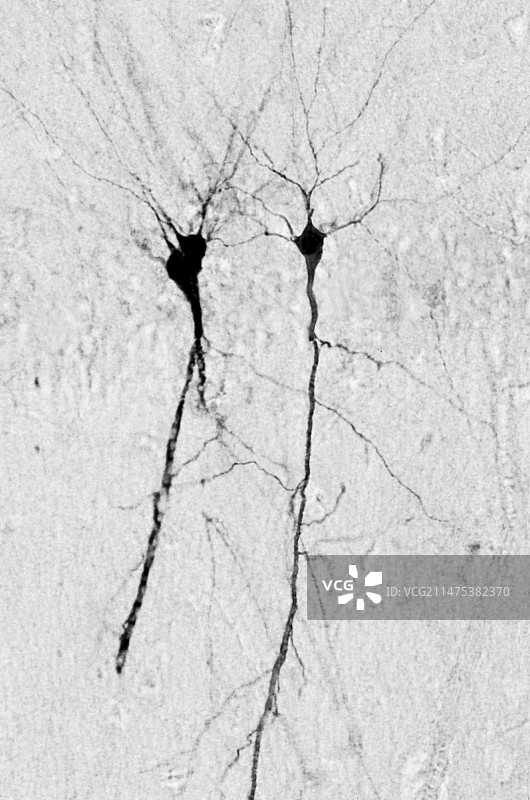 海马锥体神经元图片素材