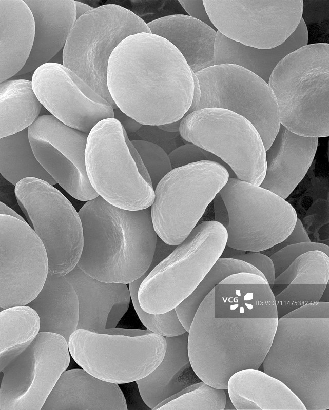 低渗溶液中的红细胞扫描电镜图图片素材