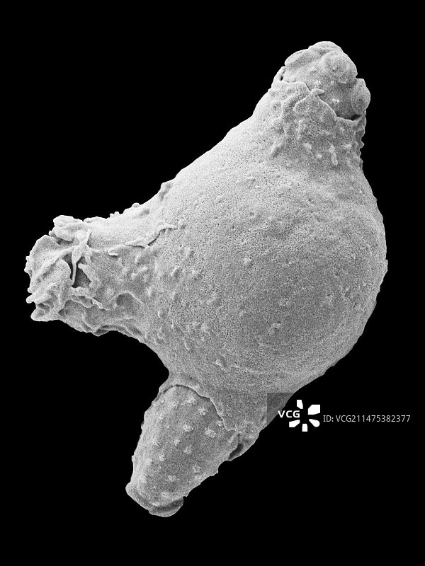 中性粒细胞吞噬念珠菌，扫描电镜图片素材